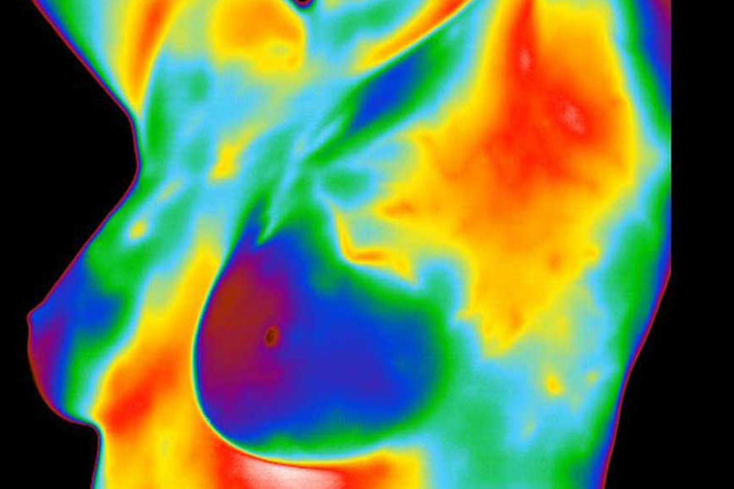 thermography.blog.image