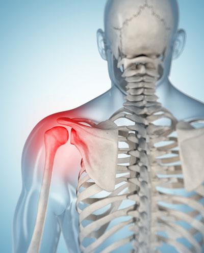 Digital rendering of a skeleton with red irritation on the shoulder